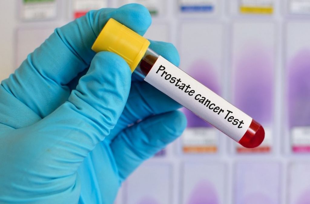 Prostate Cancer Screenings: Different Screenings That Are Easier on Patients